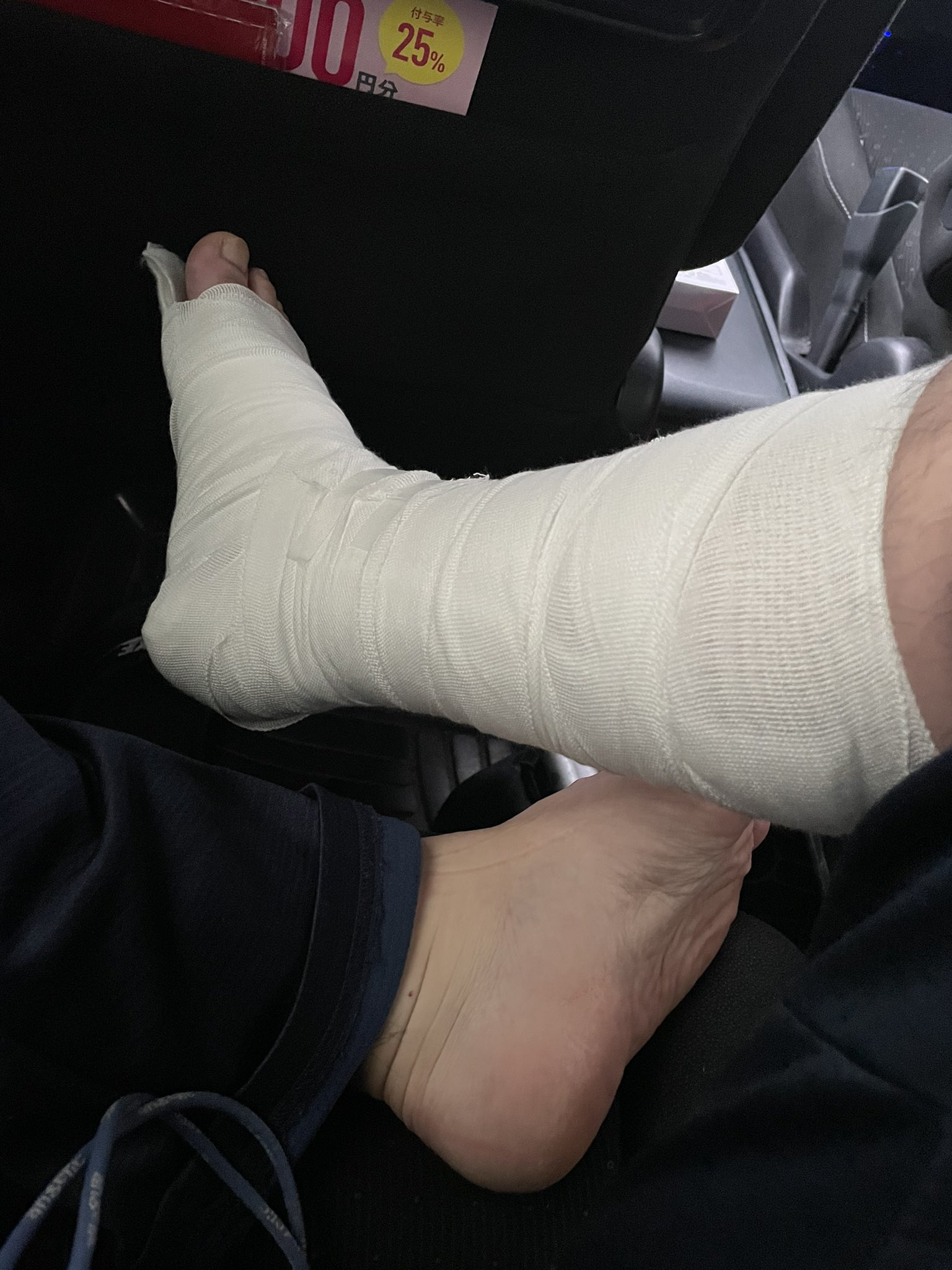 Sayahaya 踵骨骨折から1ヵ月 ようやく装具になった 早く歩けるようになりたいなー 踵骨骨折 踵骨折 装具 T Co Edijmgpxbr Twitter