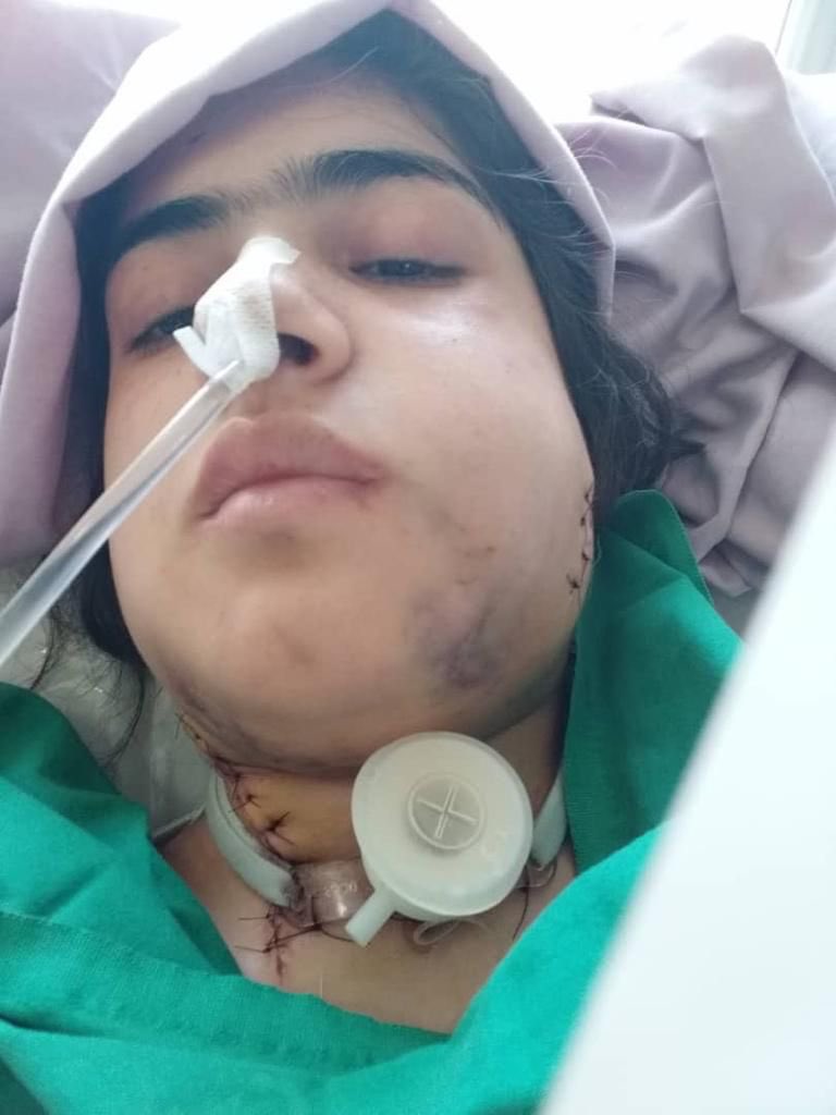 womenaidafghan1's tweet photo. The girl's name is Mursal Hamidi. On the day the American soldiers left Kabul airport, where a suicide bomber struck while going to France to study, he was shot by an American soldier and was shot in the throat and larynx. From that date until today, https://t.co/djceRDalkR