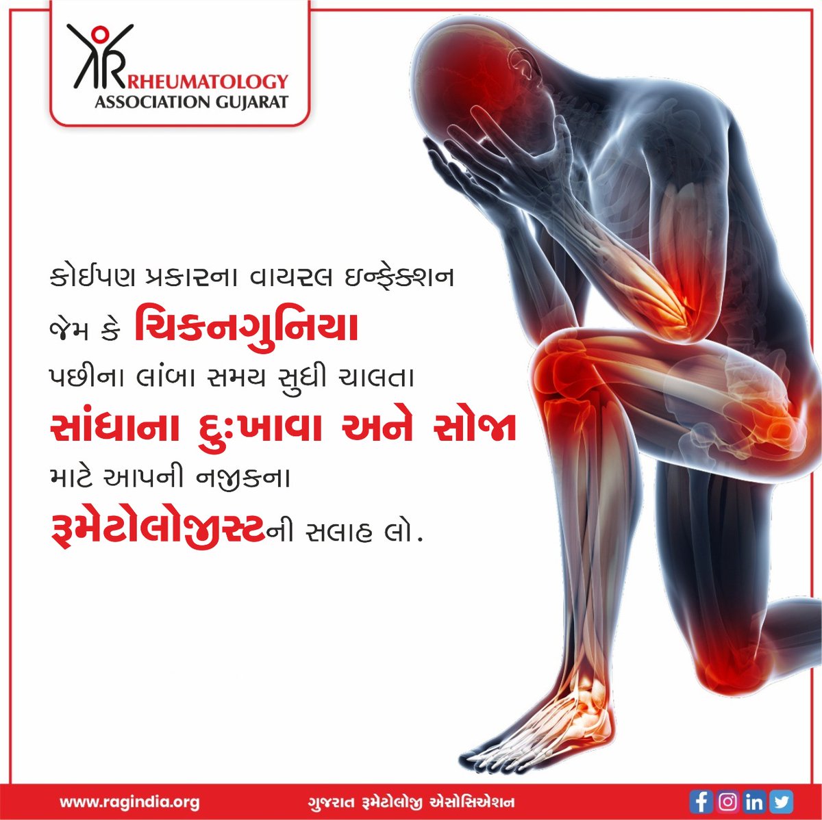 raggujarat's tweet photo. Kindly consult your nearby rheumatologist If you have persistent symptoms such as joint pain - swelling after any viral infection (like chikungunya).

https://t.co/zrzz3GPcKG 

#RAG #Rheumatologist #Rheumatology #Fight #Arthritis #JointPain #jointhealth #ragindia https://t.co/shvam4lnbs
