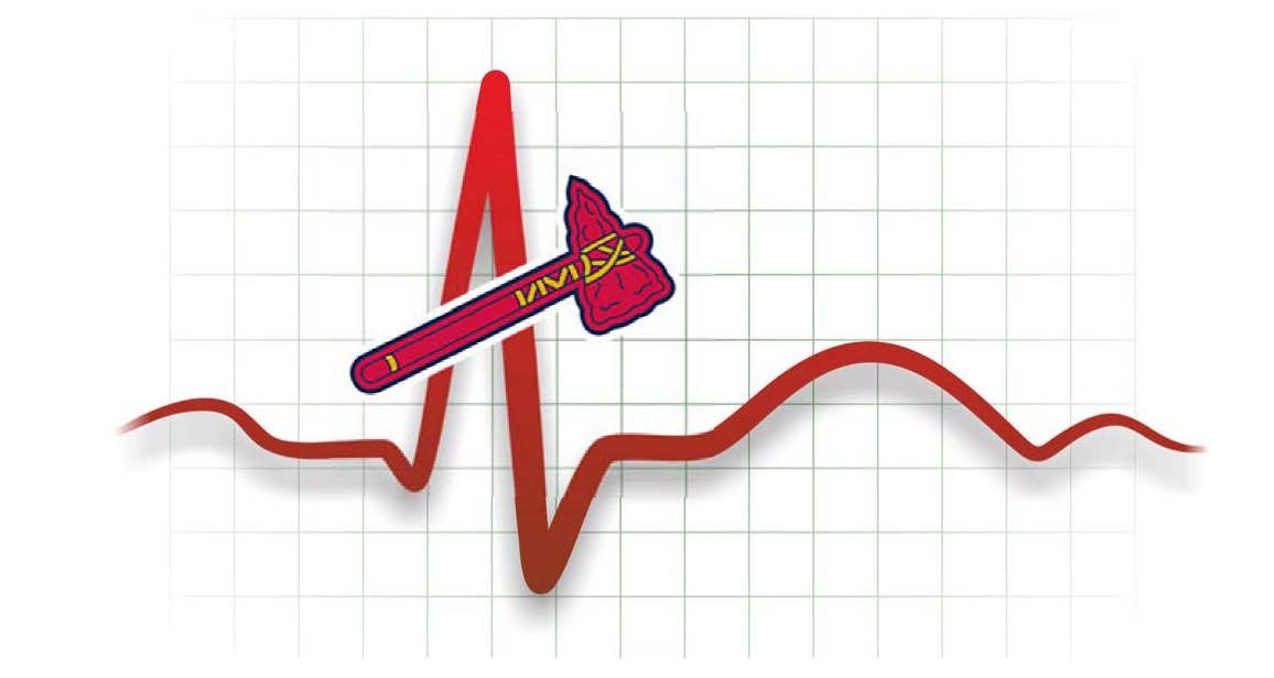 Emory Division of Cardiothoracic Surgery (@emoryctsurgery) on Twitter photo Stand clear PEA... There's a new unshockable rhythm in town. Congratulations to our hometown #WorldSeries2021 CHAMPS <a href="/Braves/">Atlanta Braves</a>.
#AtlantaBraves #atlanta #MLB #ChopOn Stand clear PEA... There's a new unshockable rhythm in town. Congratulations to our hometown #WorldSeries2021 CHAMPS <a href="/Braves/">Atlanta Braves</a>.
#AtlantaBraves #atlanta #MLB #ChopOn