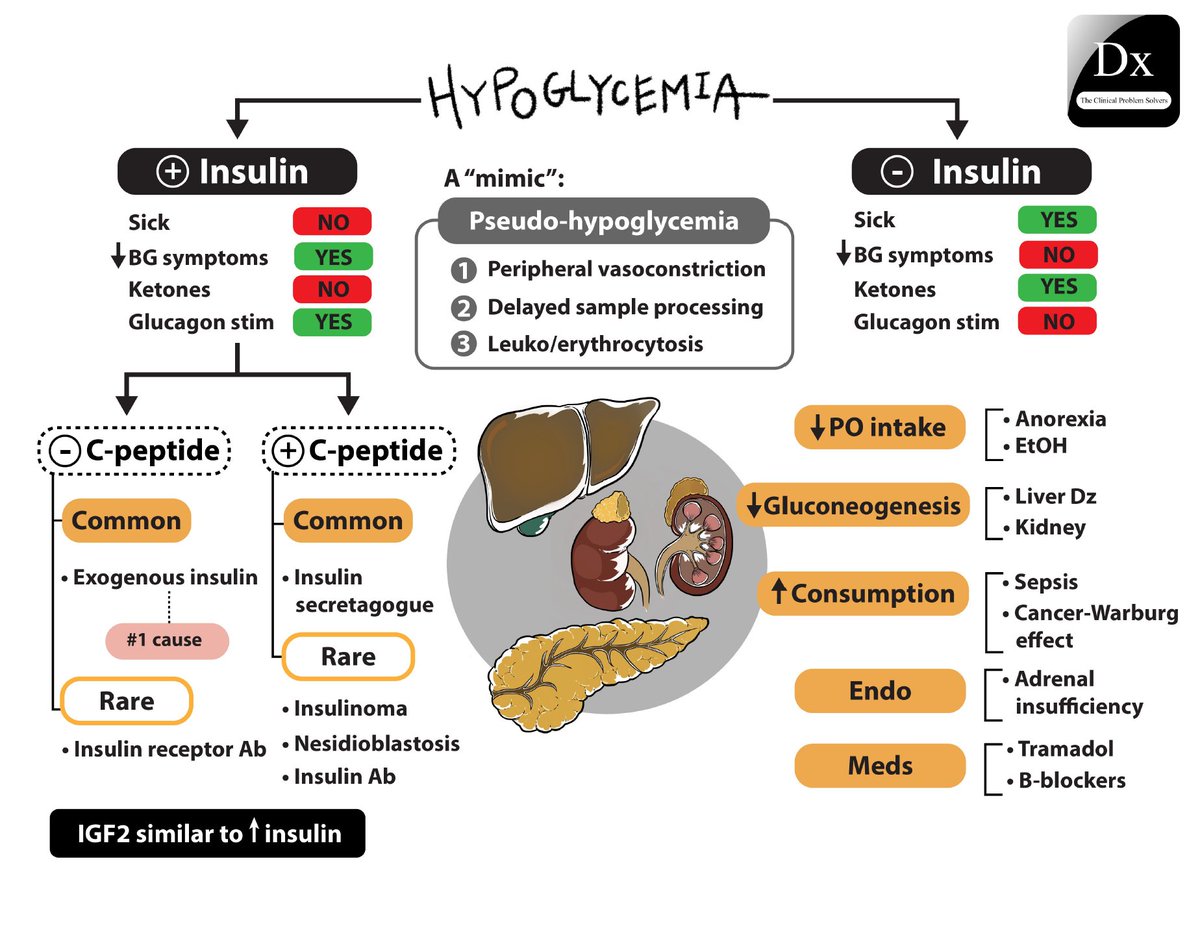VCU_IMRes's tweet image. (1/4) New #MRpearls from PGY4 Med-peds Josh Bates who presented a case of hypoglycemia in a patient without diabetes. Do you have a way to approach hypoglycemia workup? See below schema from @CPSolvers and our pearls listed below!
#medtwitter #minitutorial #physiologyfunfacts