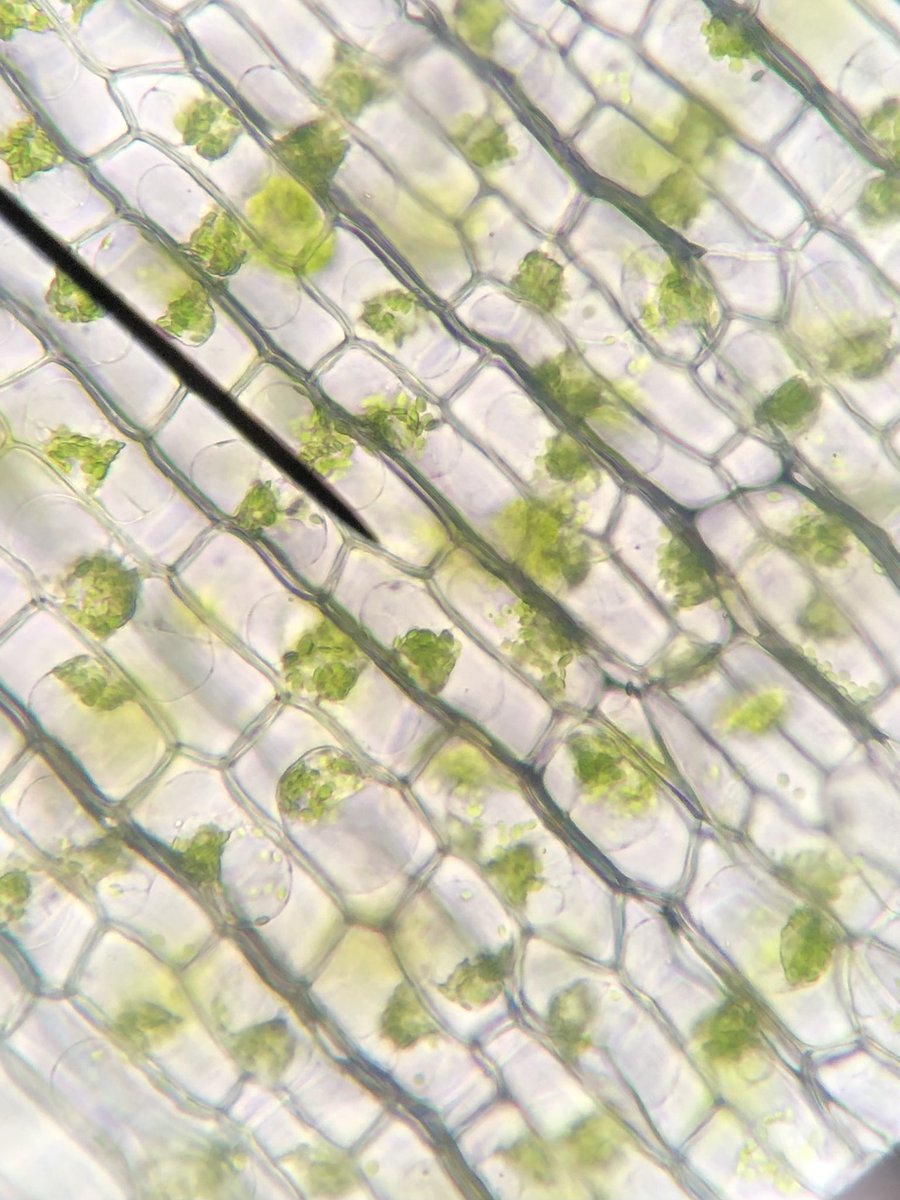 STMsrichards's tweet image. Elodea in hypertonic and hypotonic solutions .  Can you tell which is which ?  My students can !!  #osmosis #microscopelab #handsonlearning #ilovescience @stmsaints