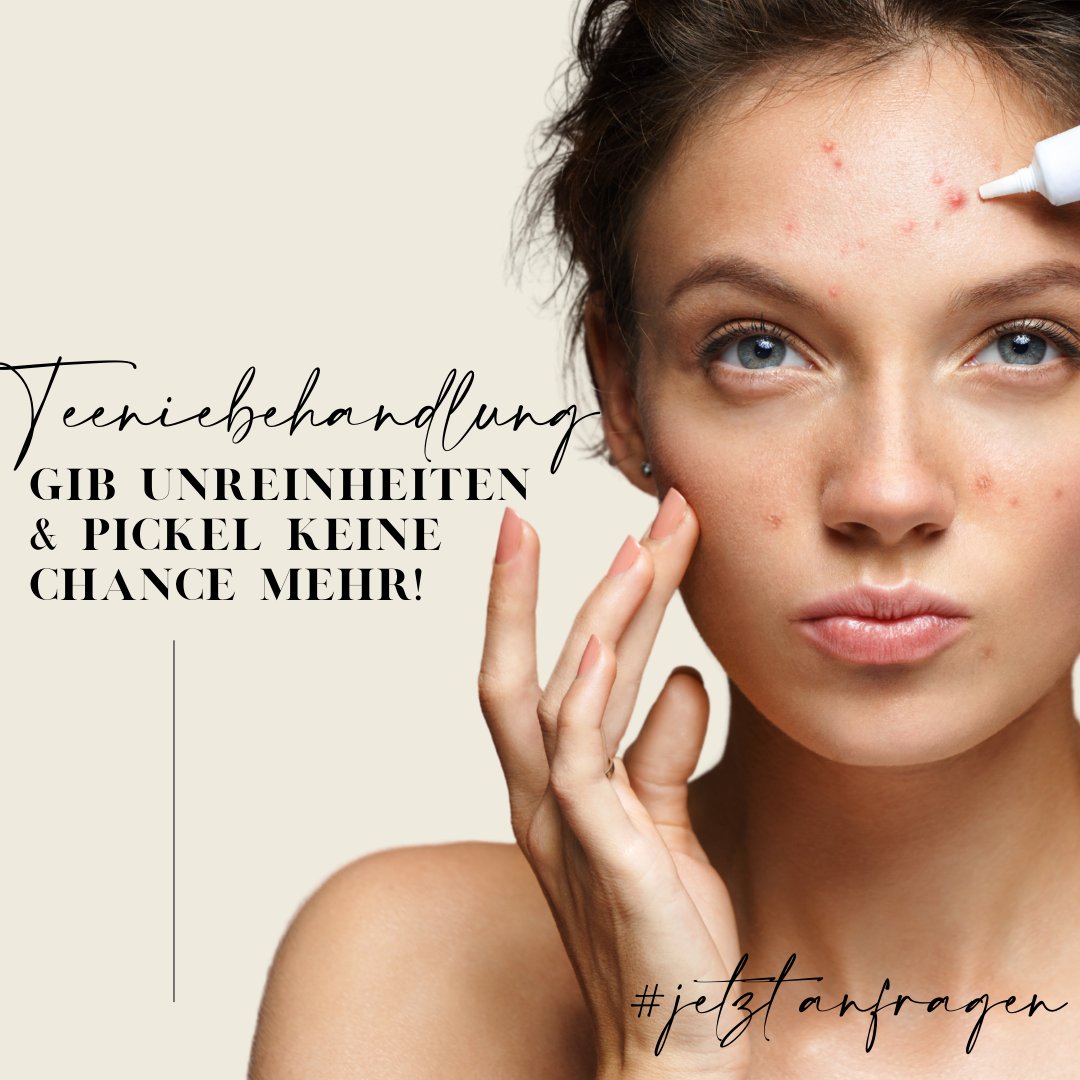 SSalvel's tweet photo. Gib Unreinheiten und Pickel keine Chance mehr! https://t.co/mSlI8qNmt8