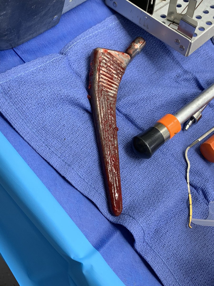 18 minutes and another win for the patient!!  #orthotwitter #noETO