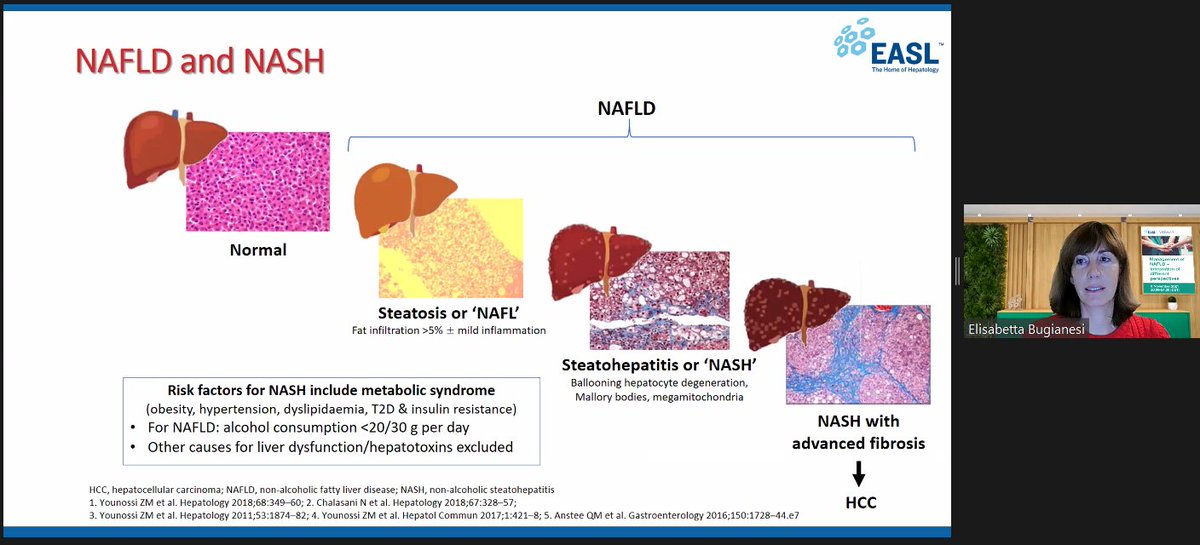 EASLnews's tweet photo. Prof. Elisabetta Bugianesi giving a summary on #NASH and #NAFLD during the #EASLwebinar "Management of NAFLD โ Integration of different perspectives"
@KathrynJackNHS @liverphysio @KuePatrizia
@livernursing @PalleBager @liver_dietitian @FpNuria https://t.co/FlCSxorAHC