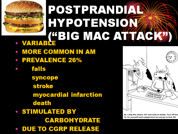 drjohnmorley's tweet photo. Post Prandial Hypotension a common cause of syncope in old persons and persons with diabetes https://t.co/3lwNC1sQwi