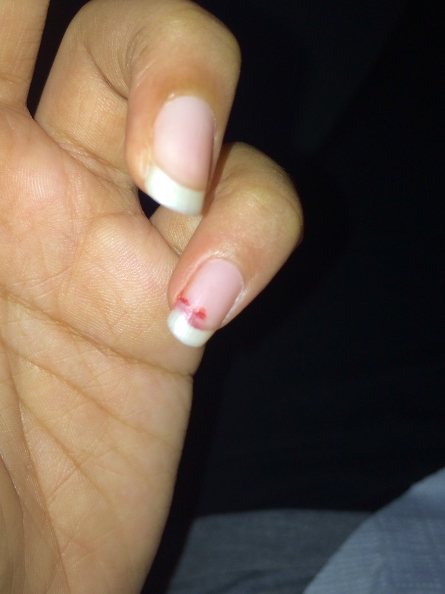 ricekid03's tweet photo. girls can relate to this pain https://t.co/neeeBWr8ru