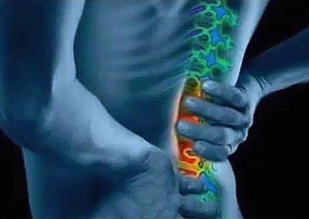 somethinglovely's tweet image. my back after carrying the weight of being a complete failure all my life