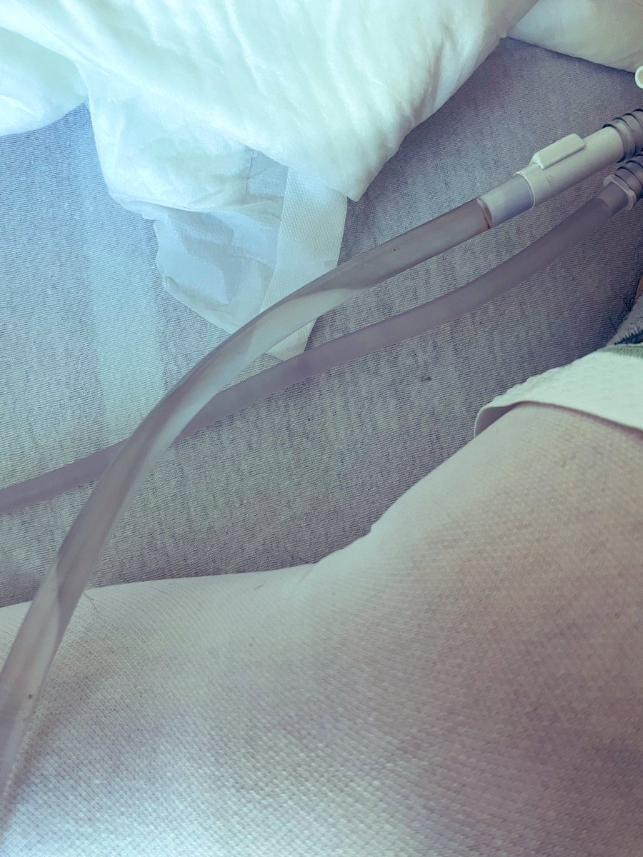 HOLEP: mínima invasión, hospitalización y catéter x 1 día, 100 grs enucleados, 2 hrs de cx…mejor opción para tratamiento definitivo en HPB #UroSoMe #lumenisU #AEEP