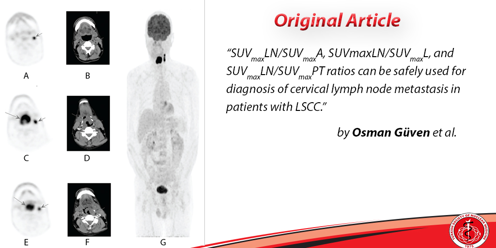 MIRTOfficial's tweet photo. The Predictive Value of Proportional Evaluation Based on the Metabolic Activity of Cervical Lymph Nodes on PET/CT Imaging in Patients with Larynx Cancer
#Cervicallymphnode #metabolicactivity #larynxcancer #MedicalJournal #multimodalityimaging
https://t.co/XBtyXKUBfw https://t.co/Yn2cVbq3Y8
