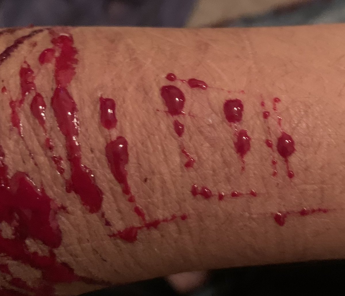 doodooheadass71's tweet photo. tw-cw:/ sh blood
-
-
-
-
-
-
-
-
-
-
-
-
-

a#-

a#-
-

_shtwt barcodetwt yeettwt 
wishing i was drunk or higj asf😳🙄 https://t.co/CWN8xEge0M