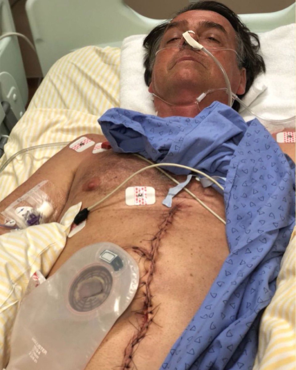 FlavioBolsonaro's tweet photo. Nós temos o direito de saber quem mandou matar meu pai @jairbolsonaro !

Até hoje sofre as consequências da facada que levou de antigo filiado do PSOL, braço do PT. 

E a angústia de uma sempre possível nova cirurgia o acompanhará pelo resto de sua vida! https://t.co/efMhCiViKB