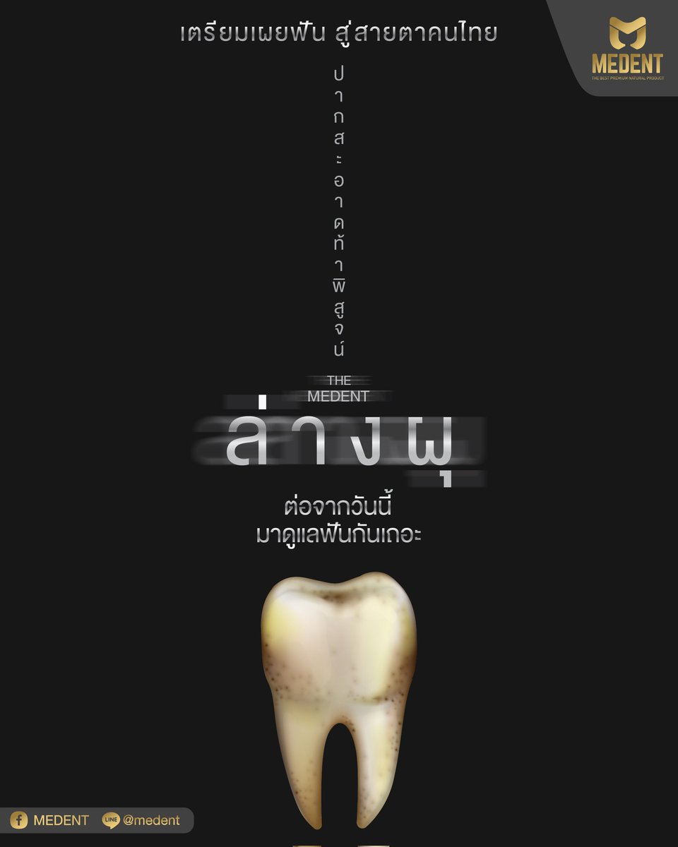 ต่อจากวันนี้ มาดูแลฟันกันเถอะ 🦷
.
#MEDENT