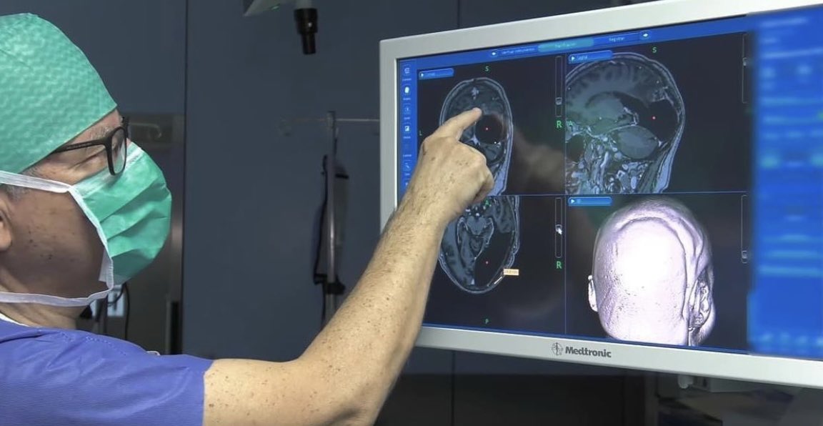 Neuroinstitut_'s tweet photo. #Sabiasque Los #liomas son #tumores primarios en el #cerebro que se diferencian segun sus grados de #agresividad https://t.co/hIOR0IEsd6