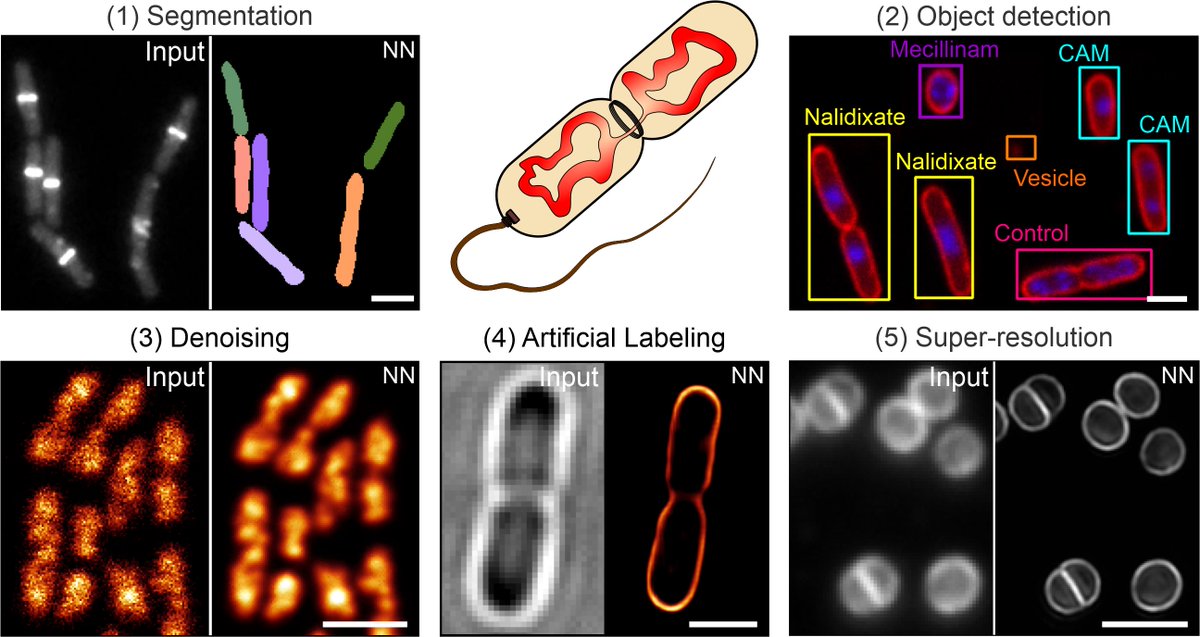 miCHRIScopy's tweet image. Happy to share our preprint on DeepBacs, a project dedicated to all bacteriologists working with #microscopy. In #DeepBacs, we employ open-source #DeepLearning tools for various tasks in bacterial bioimage analysis. A thread will follow soon! 🦠🔬🧠
biorxiv.org/content/10.110…