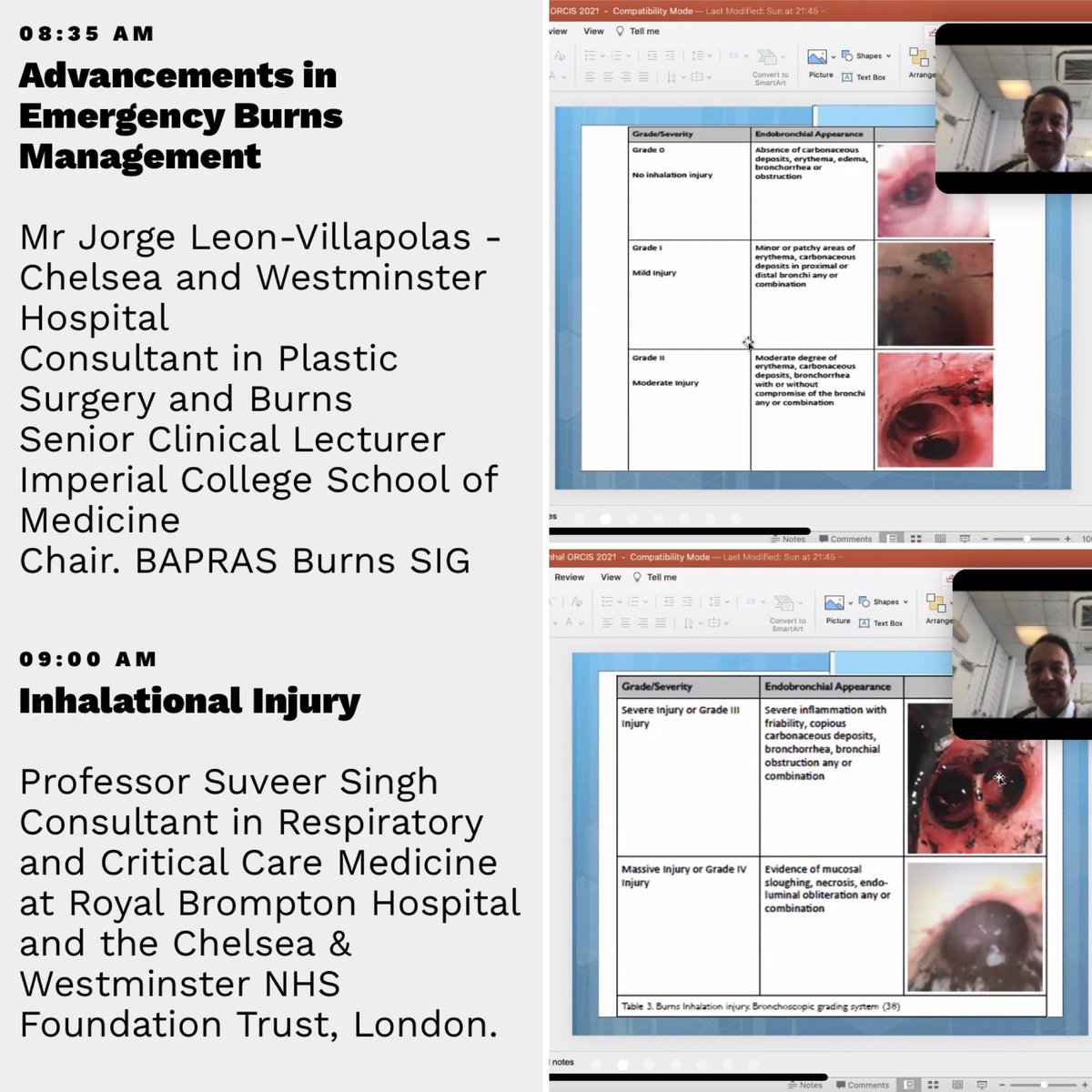 lucyhalpin1's tweet photo. ORICS winter meeting has kicked off online! Excellent program and a packed educational day with a #trauma focus.

#ORICS2021
#ACCP https://t.co/W474Goj8HP