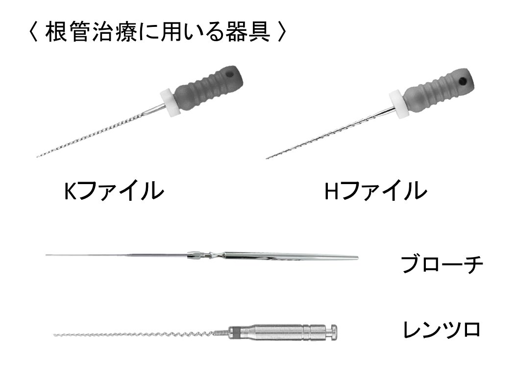 根管治療に用いる器具】 Kファイル、Hファイル・・・主に上下の手動