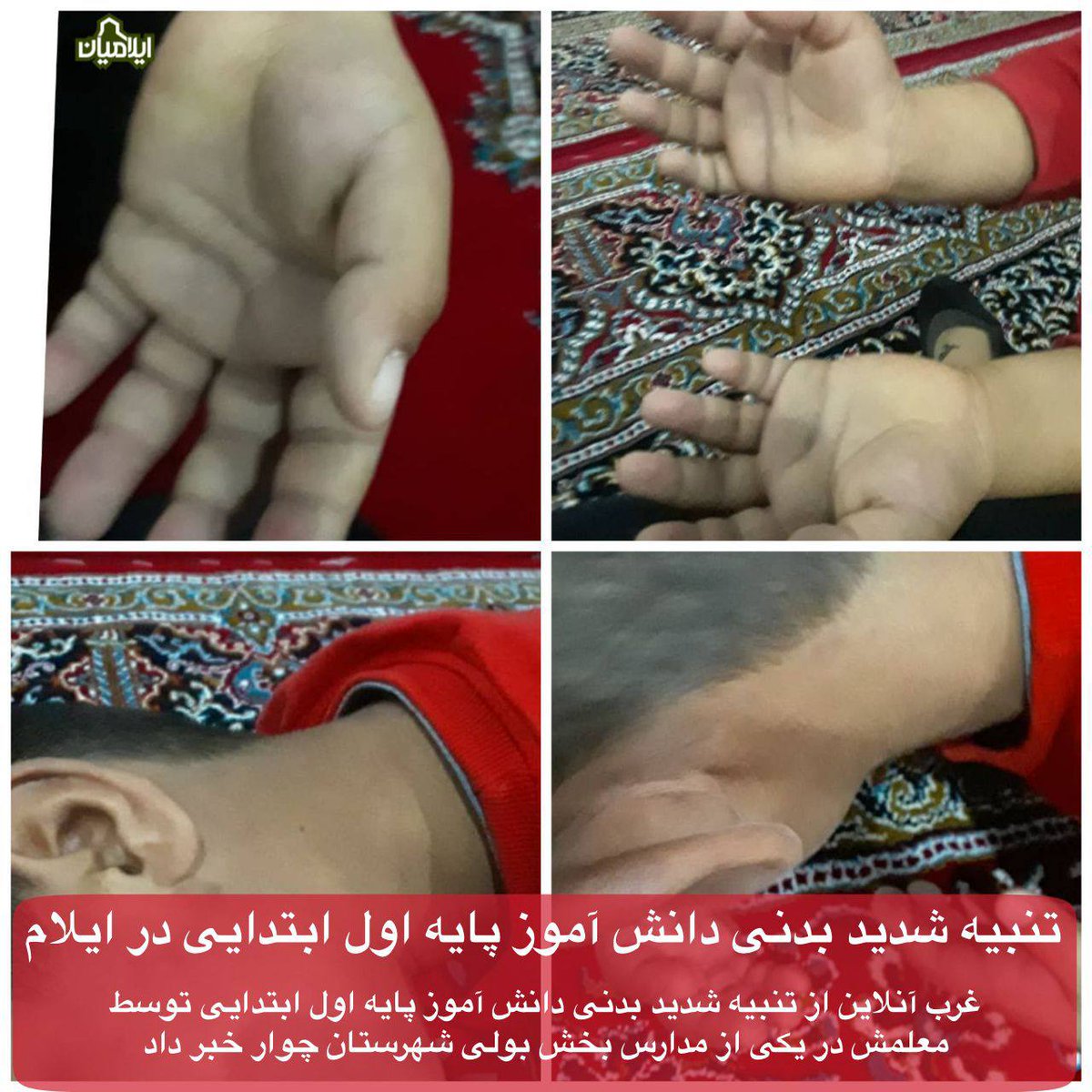 ilamiyaan's tweet photo. تنبیه بدنی دانش آموز کلاس اول در ایلام!

غرب آنلاین مدعی شد؛
یک معلم در یکی‌از روستاهای بخش‌ بولی شهرستان چوار اقدام به تنبیه شدید بدنی یک دانش آموز کلاس اول ابتدایی کرده است!
آثار ضرب و جرح بر نقاط مختلف بدن این دانش آموز مشهود بوده و هم اکنون جهت درمان در شهر ایلام به سر میبرد! https://t.co/GdLoxBYXPz