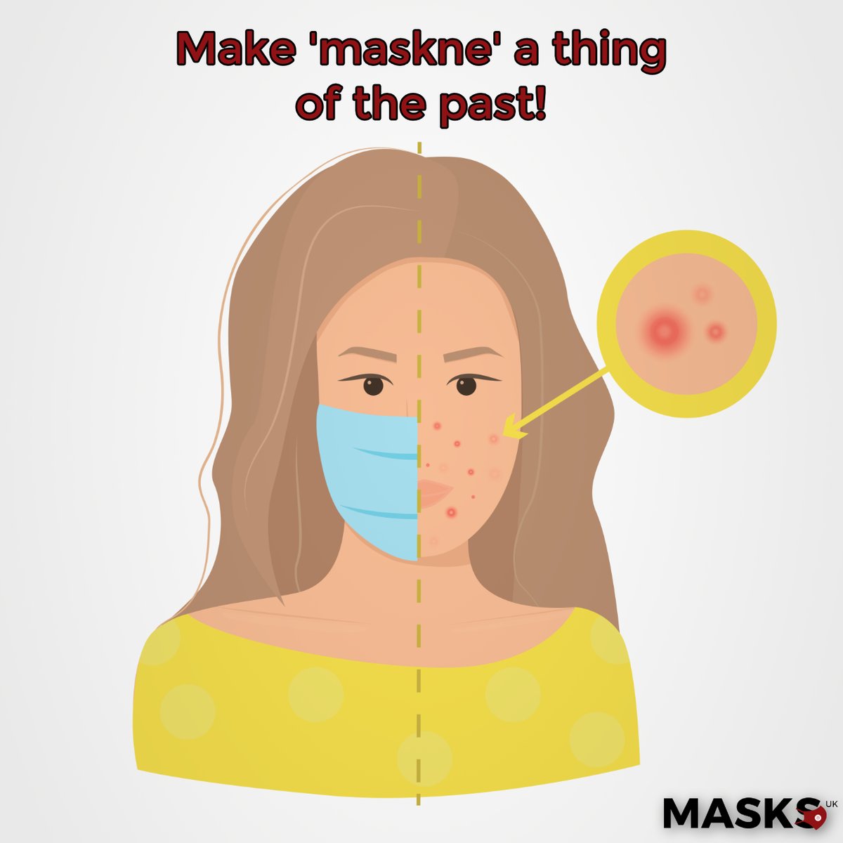 MasksukOfficial's tweet photo. Maskne the 'Face Mask Acne' π·
Struggling with break-outs or skin irritation from wearing face masks? Well, struggle no more! All of our masks have passed ISO British Standards & include nanotechnology.
Get yours now - https://t.co/6UGCJneL4K
#MasksUK #SafeScienceStyle https://t.co/V9rDTnTNtC