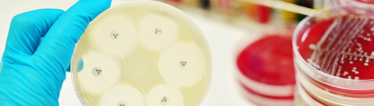 FBMH Social Responsibility and Public Engagement (@fbmh_sr) on Twitter photo **Spread awareness, stop resistance!** Registration is now open for <a href="/AMS_UoM/">Antimicrobial Resistance Network @ UoM</a> webinar for Antimicrobial Resistance Awareness Week on 23/11, open to all, register here - bit.ly/3bFQ5Lf <a href="/wendythedentist/">Wendy Thompson</a> @_FaceSA <a href="/Shamian001/">Mark Smith</a> <a href="/FBMH_UoM/">UoM Biology, Medicine and Health</a> #AMR #AntibioticStewardship **Spread awareness, stop resistance!** Registration is now open for <a href="/AMS_UoM/">Antimicrobial Resistance Network @ UoM</a> webinar for Antimicrobial Resistance Awareness Week on 23/11, open to all, register here - bit.ly/3bFQ5Lf <a href="/wendythedentist/">Wendy Thompson</a> @_FaceSA <a href="/Shamian001/">Mark Smith</a> <a href="/FBMH_UoM/">UoM Biology, Medicine and Health</a> #AMR #AntibioticStewardship