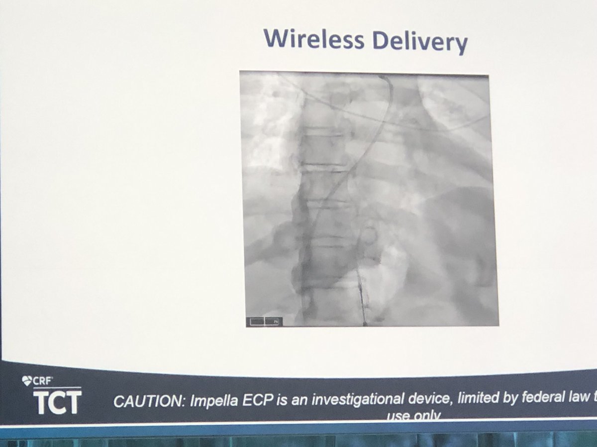DrAmirKaki's tweet photo. I had the privilege and honor to present the EFS work for the 9F ECP at TCT 2021.  This powerful technology will change the landscape for complex PCI and High Risk Patients. 4 Liters via 9F equals game changer.  Exciting times for our field and our patients! https://t.co/FDQ7GXci7B