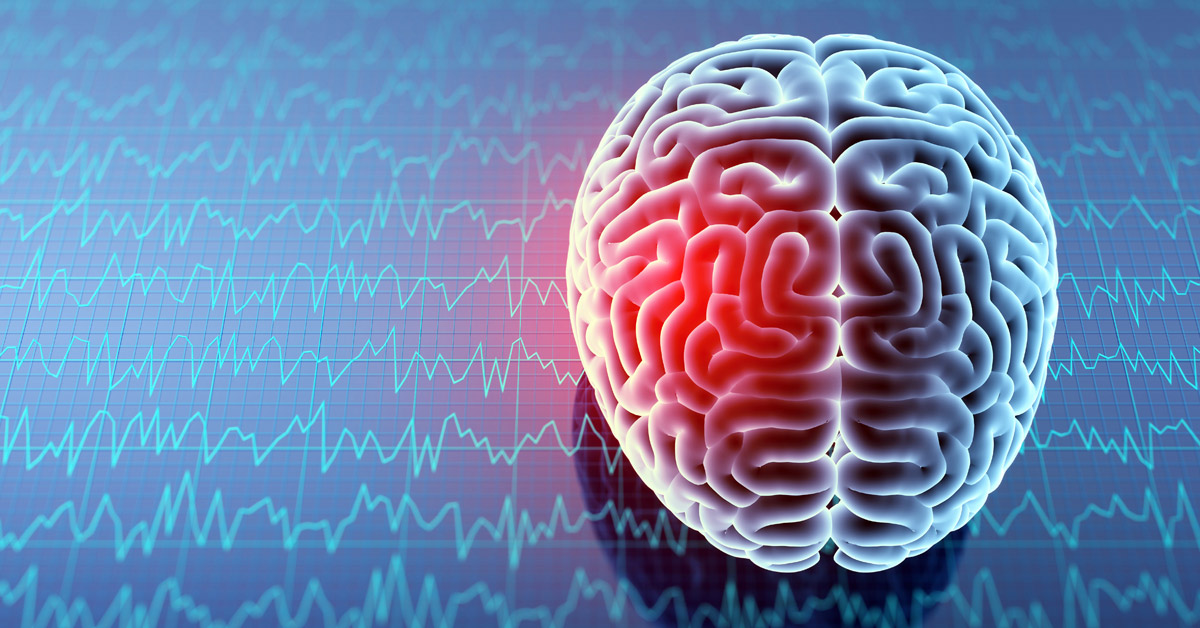 NEJMClinician's tweet photo. Light aerobic exercise following sports-related #concussion reduced duration of recovery and persistent symptoms in adolescents, compared with complete rest. https://t.co/TKF6F5TiO6 https://t.co/sWXBdtDPuK
