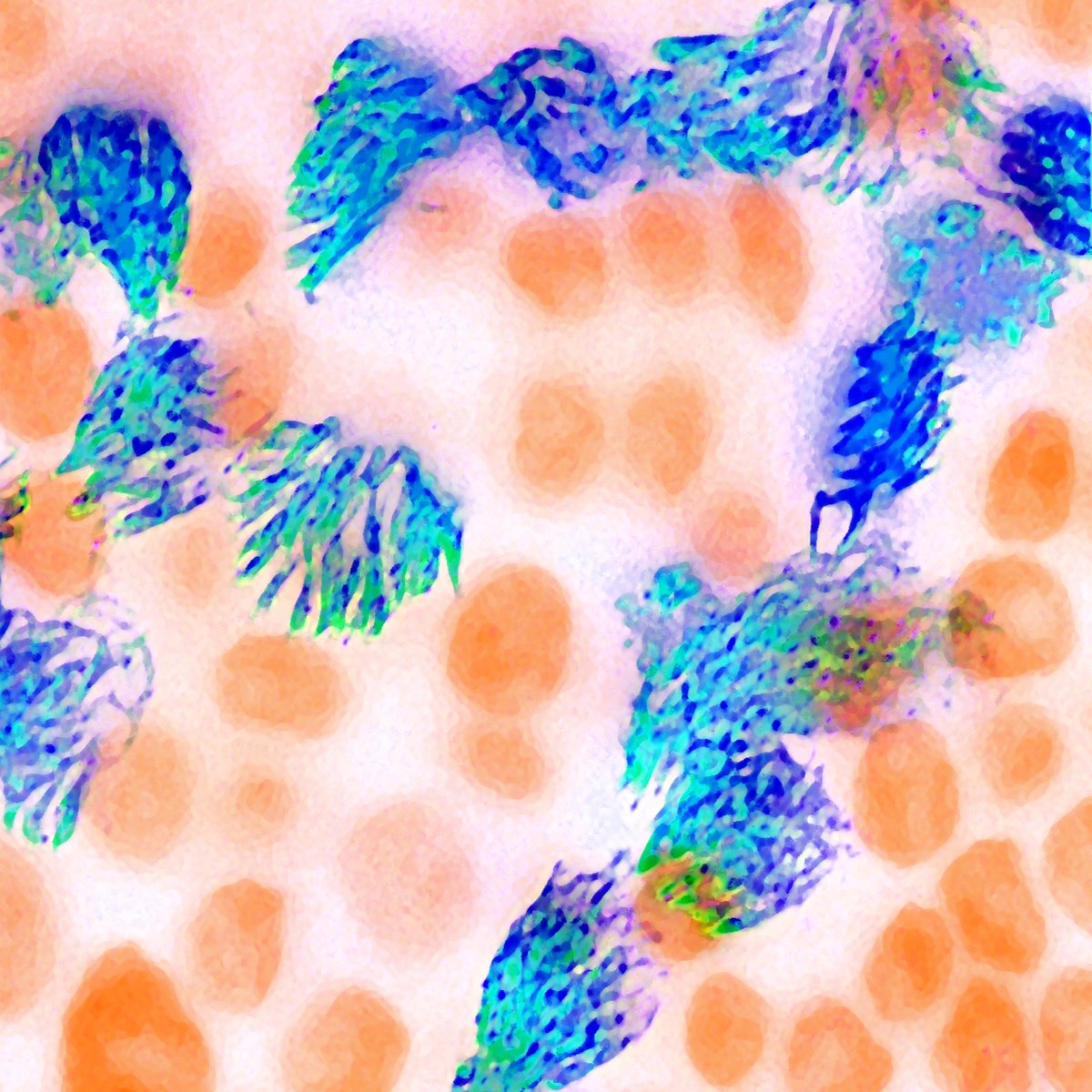 November is #COPDAwarenessMonth! "Sweeper" shows specialized cells lining the airway with their bristle-like appendages, cilia, that clear the respiratory garbage that we breathe in. More info bioartography.com/products/sweep…

#supportscience #stem #steam #bioart #sciart #microscopy #lung