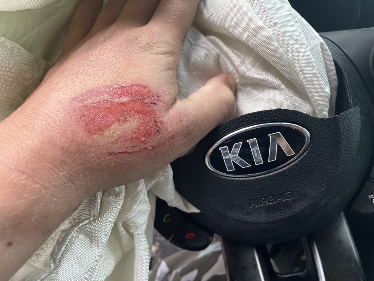 David_Bush's tweet image. I must say @Kia, your customer service is starting to disappoint. A month ago 'Steve' (your rep who joked about the logo-scar I got from your car) said the same thing as your tweet (itself now a week old) and I've STILL not heard a thing. And this thing keeps reminding me: