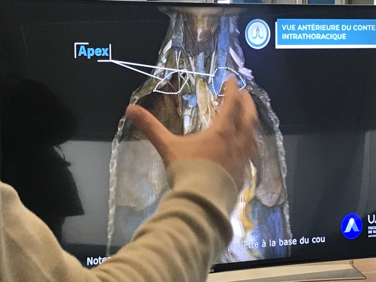 Pas eu le temps de venir découvrir Akivi, retrouvez-le ici ➡️ akivi.fr
Nouvelle façon d'apprendre l'anatomie en #3D  et en #réalité #virtuelle #Projet #innovant 
<a href="/CarballidoLoic/">Loïc Carballido</a>  <a href="/chu_angers/">CHU Angers</a> <a href="/_AllSims/">ALL'SIMS</a>
