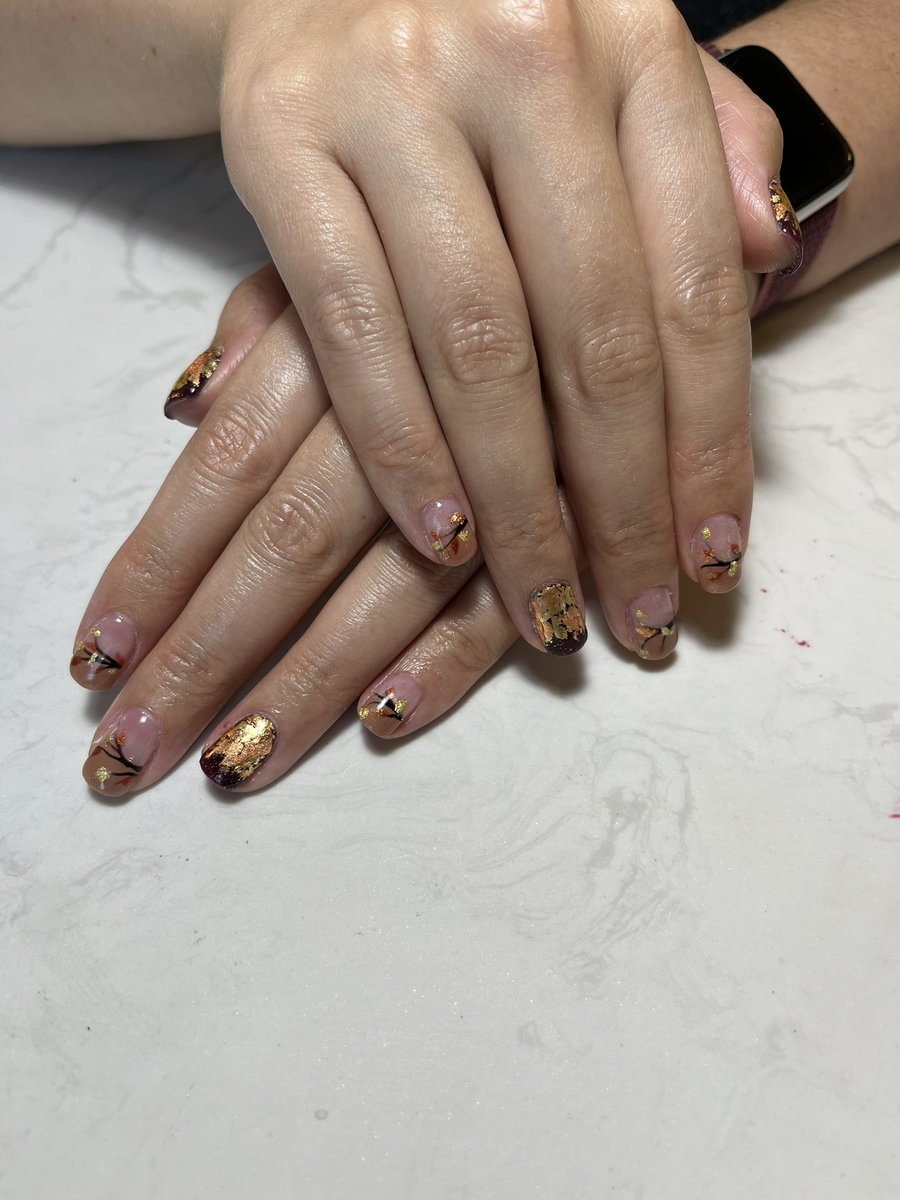 MarcieFeinman's tweet photo. Fall nail vibes!! @elliotthaut @arghavan_salles
#handsofasurgeon https://t.co/dysxoC6fdx
