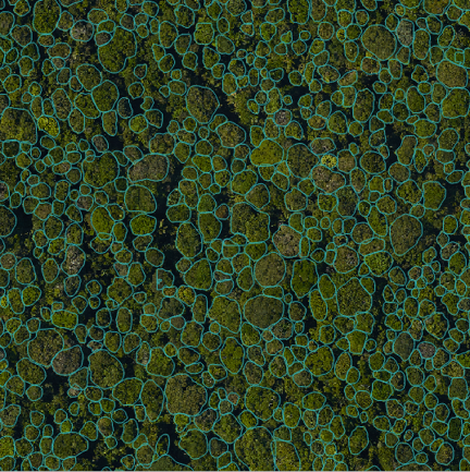 1/5 #TropiCon21
detectreeRGB is a new tool to segment trees in RGB images. I'll show how it works and how it can be used in ecology. 

This work was mostly done by Sebastian Hickman (not on Twitter) at the Cambridge <a href="/AI4ER_CDT/">AI for Environmental Risks CDT</a> 
and <a href="/JgcBall/">James Ball</a> <a href="/plantsci/">Muhammad Tayyab</a>