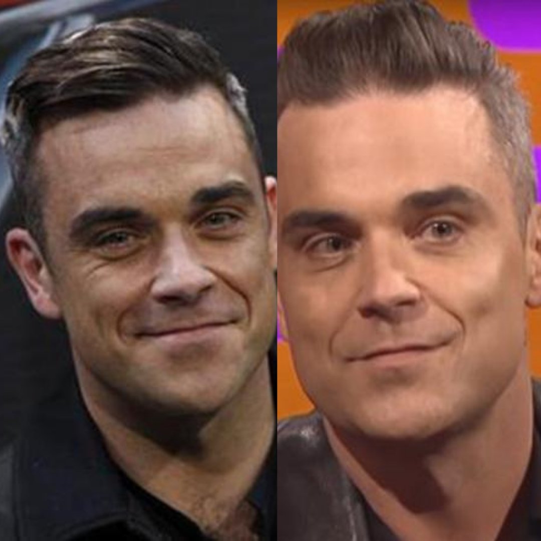 DrNinaBal's tweet photo. Some liked Mark, others preferred Gary...but my teenage crush was definitely Robbie Williams!
Back in the day, the skin was smooth, the hair was dark. Today the hair is more salt and pepper, but the skin is still pretty smooth, how is that possible? Find out on my IG! https://t.co/fLARJbaxk7