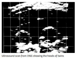 LozierInstitute's tweet image. How it started:                           How it's going: