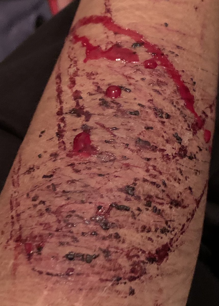 doodooheadass71's tweet photo. tw-cw// sh, blood 
-
/

-
a#-
#-
-
-
-
-
-
-
-
-
-
-
-
do you guys post publicity or what shtwt barcodetwt yeettwt https://t.co/4n2L8bNxQt