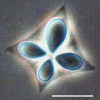 NicoJSmit1's tweet photo. Day K for #ParasiteABC - Kudoa thyrsites a myxo globally found in marine fishes. It cause post-mortem softening of muscle making host fish unmarketable. Originally described from South Africa and locally known as "pap snoek" snoek = type host Thyrsites atun 📸 Levsen et al. 2008 https://t.co/1gs1FJ5dKR