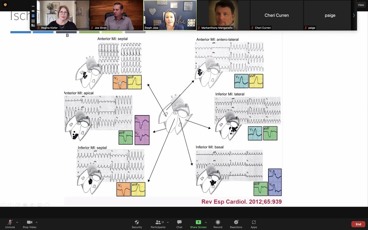 ChartAcademy's tweet image. #VTach with the expert @JasaSteph!
#leadership #mentor #epeeps #epcourse #cardiotwitter #NurseTwitter #epfellows #ablation #arrhythmia #vivaep