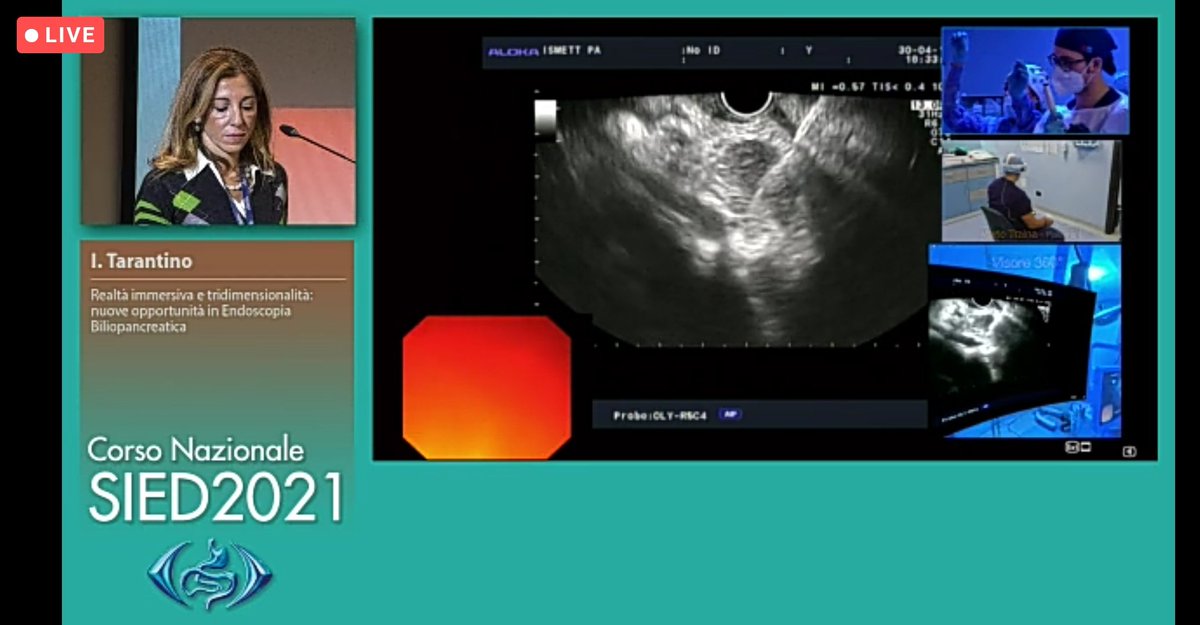 GiacomoEMRizzo's tweet photo. #honored and #grateful to Dr.ssa Ilaria Tarantino e Dr. Mario Traina for letting me experience #EUSFNB during #immersivereality presentation at #SIED2021 

#OLYMPUS #SIED #Endoscopy #future https://t.co/xmiG7N2oPk