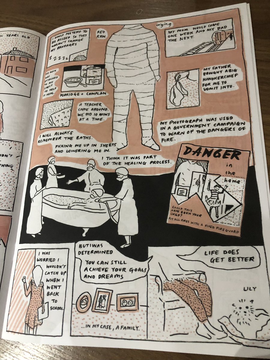 reinarzhistory's tweet photo. A glimpse into one of our stories involving Pauline, who was badly burned in her Coventry home playing with fireworks and spent three years in Bham Accident Hospital. https://t.co/Pj4vXrFpRb
