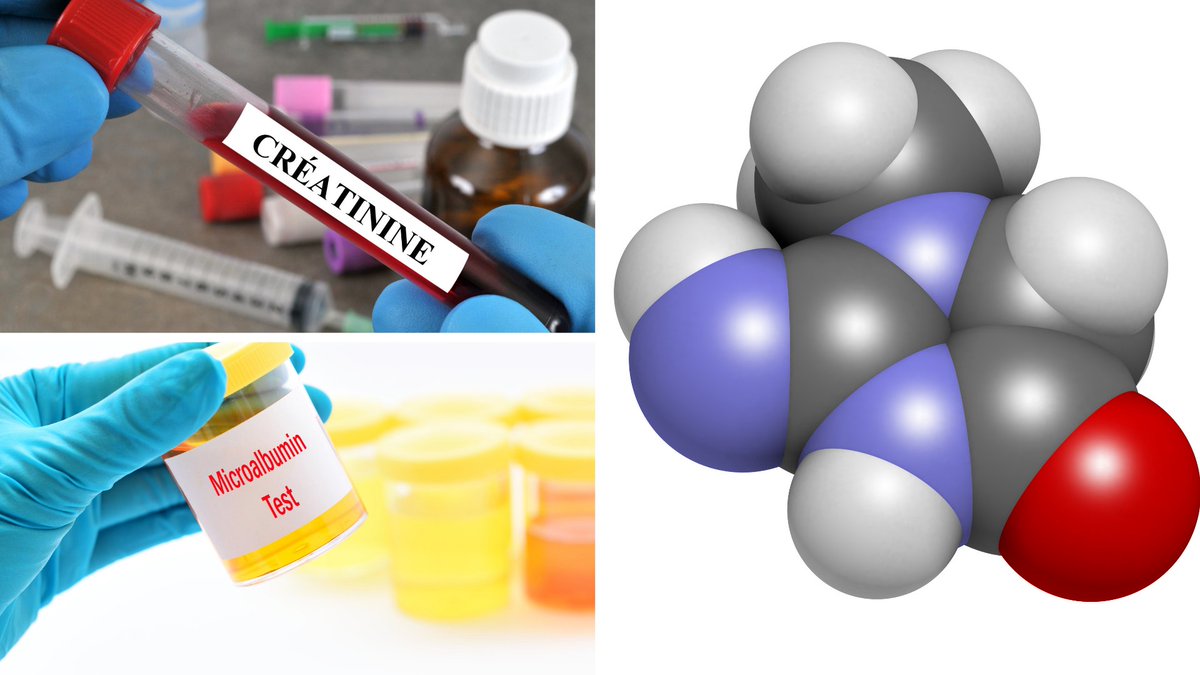 Secondmedic's tweet photo. I just published Understanding what is microalbumin creatinine ratio https://t.co/RZIS1XxsX7 https://t.co/6yiK5NT9R5