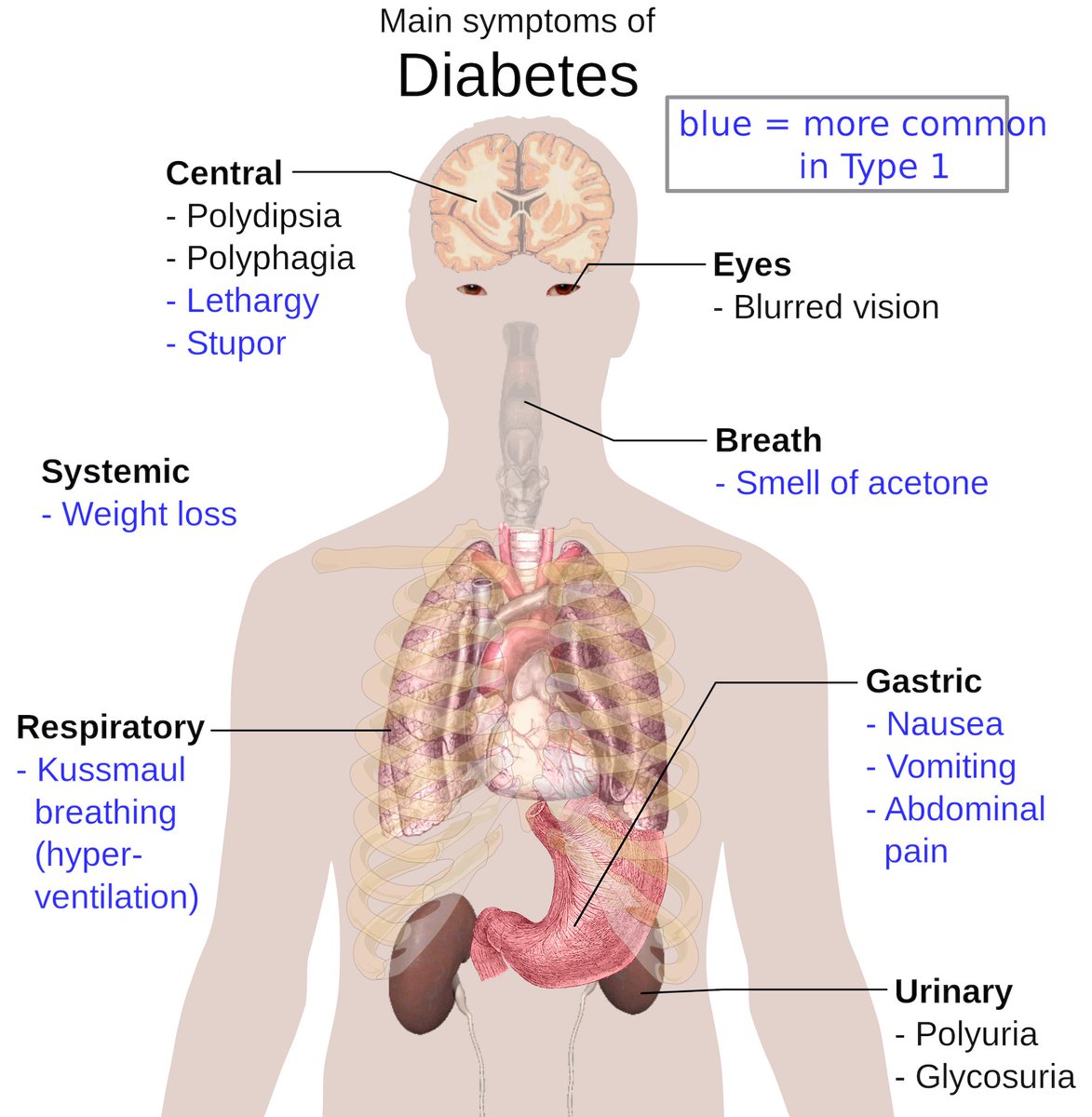 UEL_MN's tweet image. @JDRF, leading in the fight against T1 diabetes (T1D) by funding research, advocating for policies, w/ access to new therapies &amp;amp; providing a support network for millions of people impacted by #T1D. Learn more: hubs.li/H0-xZJZ0  @perky_r #NationalDiabetesMonth #ManyAgainst1
