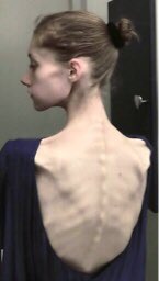 anofaiiryy's tweet photo. Took bodychecks and I love my spine so much it’s starting to look like this and I couldn’t be more excited https://t.co/tDABGjUp8w