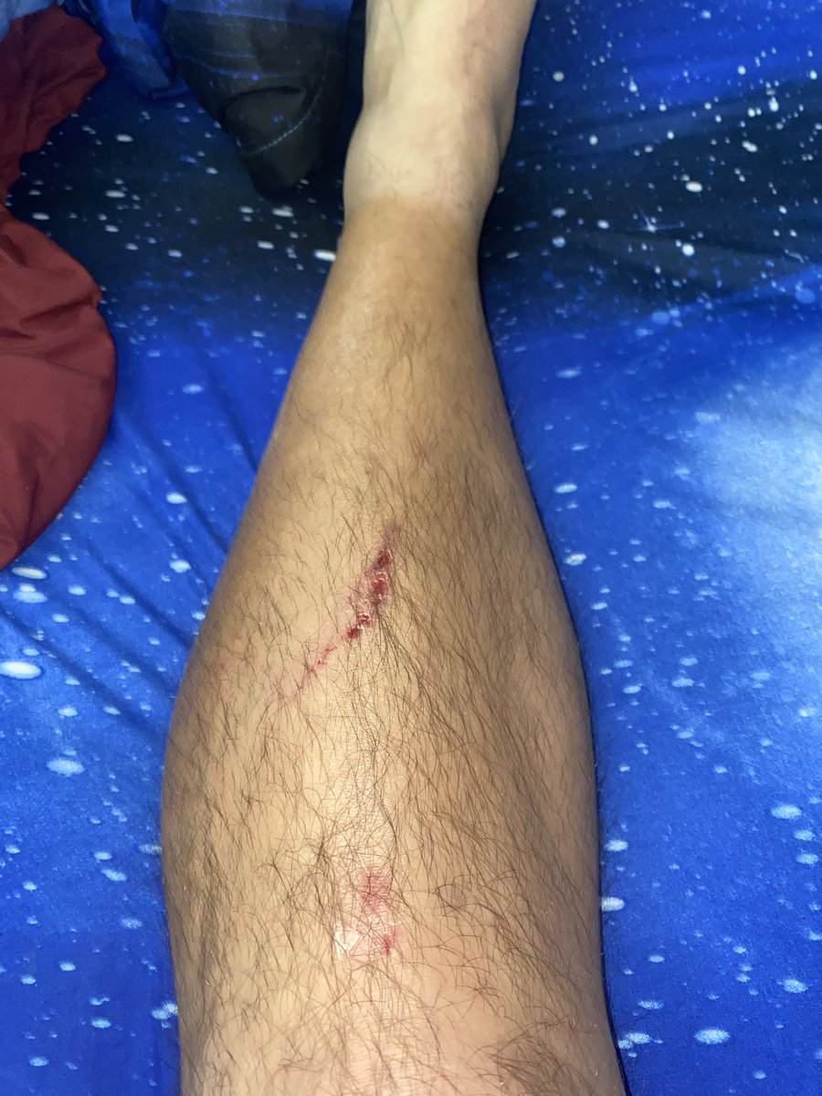 RickyDragoni's tweet photo. Sometimes you run the practice, other times the practice runs you over. #cleated #coach #football #coaching https://t.co/k8EComgOkH