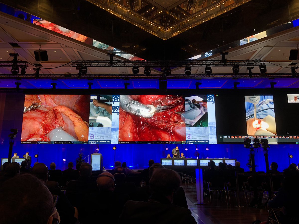 arturpaludo's tweet image. Fantastic #livesurgery RAPN session on #ERUS congress for kidney surgery lovers! Congratulation @NYCRoboticTeam @AlbertoBreda1  @NNHarke for the cases and @benchallacombe @aleantonellibs1 for the moderation! #DRUS #erus21 @ERUSrobotics