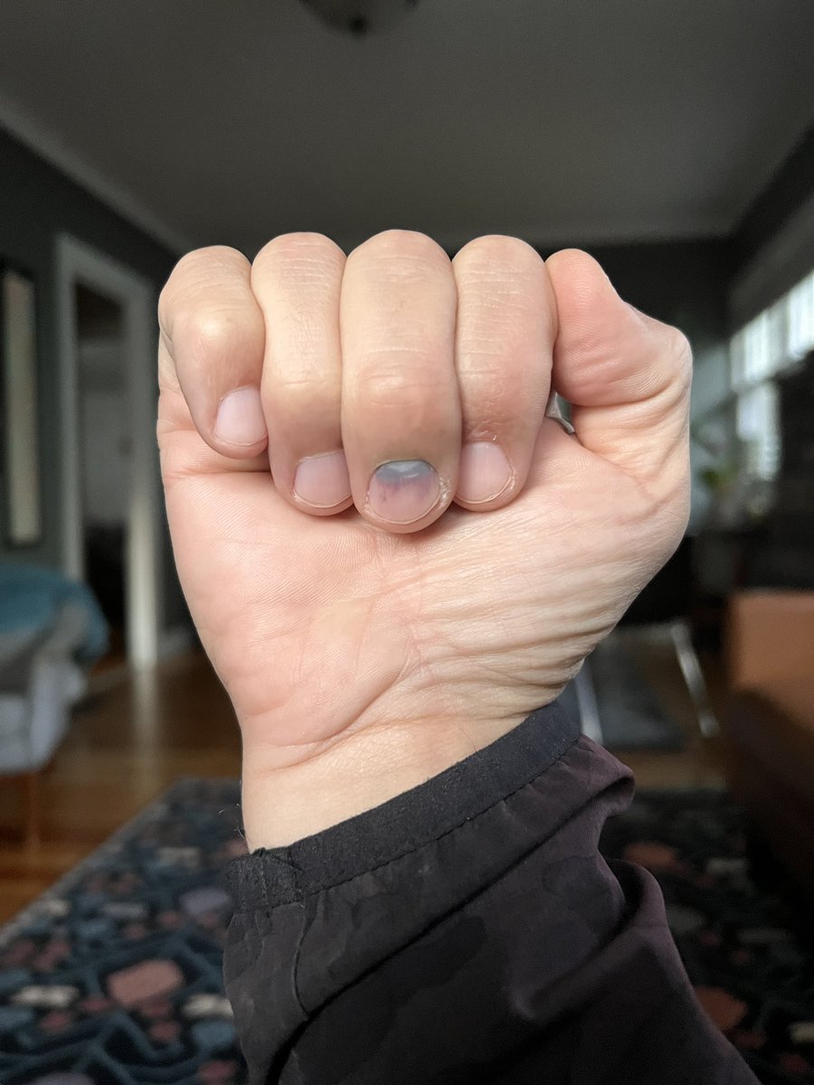 Tyler Kinley tweet media