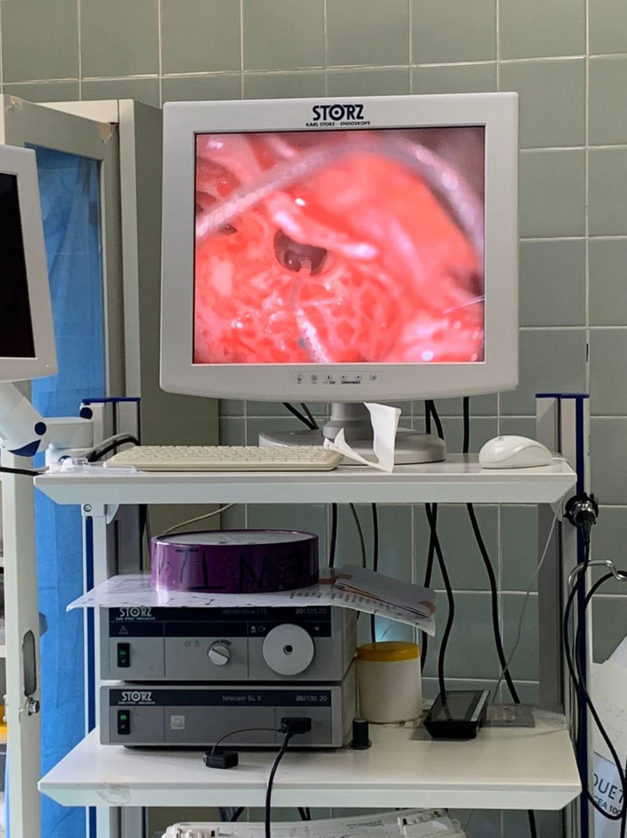 KBTH_GH's tweet photo. KBTH has successfully performed the first-ever Cochlear implant surgery in Ghana. The surgeries were carried out yesterday for two patients aged two and four years. The third surgery is being conducted today for another patient aged five. https://t.co/0baZhMQXme