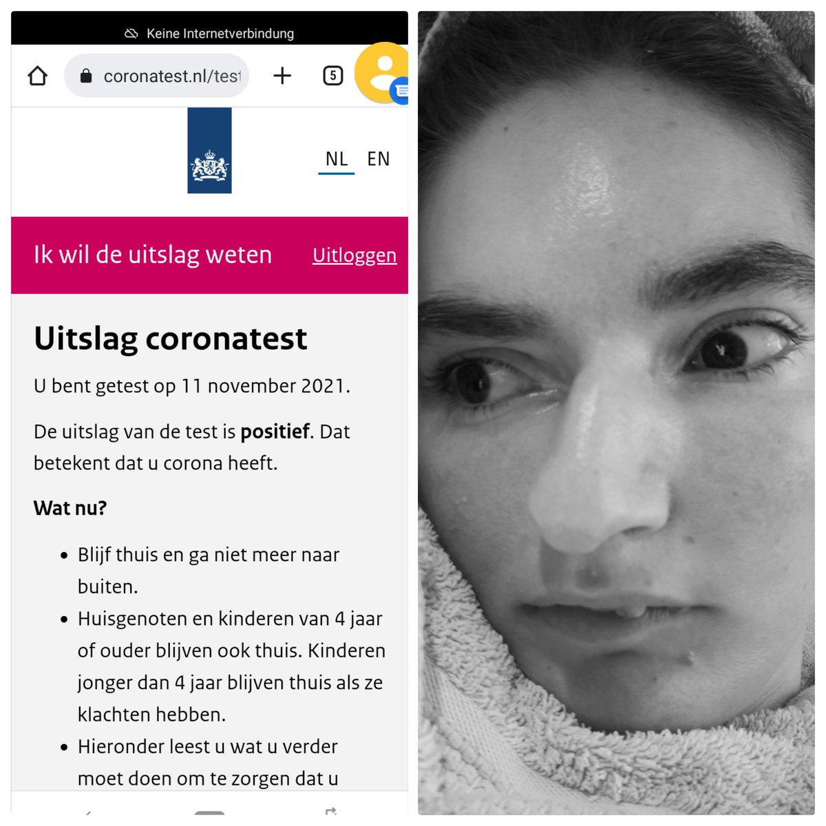 cordeva's tweet photo. Het logisch gevolg als je als zieke #zorgouder toch moet gaan zorgen. Dan besmet onontkomelijk ook je #zevmb dochter. #COVID19 https://t.co/5UhndR7WGJ