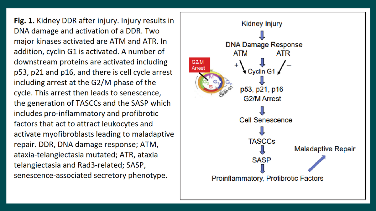NephroKarger's tweet photo. Ataxia Telangiectasia and Rad3-Related Activation by #DNA Damage Mitigates Maladaptive Repair after Acute Kidney Injury
✍ Joseph V. Bonventre
📄 https://t.co/zleijZJytI

#️Nephron #DDR #ATR #CKD #Fibrosis #TASCC https://t.co/BVdCjk139b