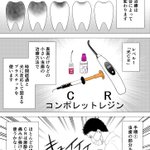 歯医者さんの治療の手順!何をしているのか分かりやすい!
