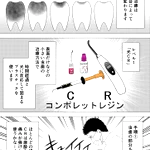 歯医者さんの治療の手順!何をしているのか分かりやすい!