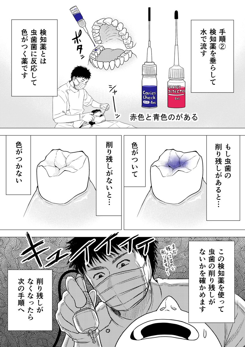 小西真冬先生のマンガ 何されてるかわからない人向け 歯の治療手順 を読んで何をしていたのか理解して安心する人々 Togetter 小西真冬先生のマンガ 何されてるかわからない人向け 歯の治療手順 を読んで何をしていたのか理解して安心する人々 Togetter